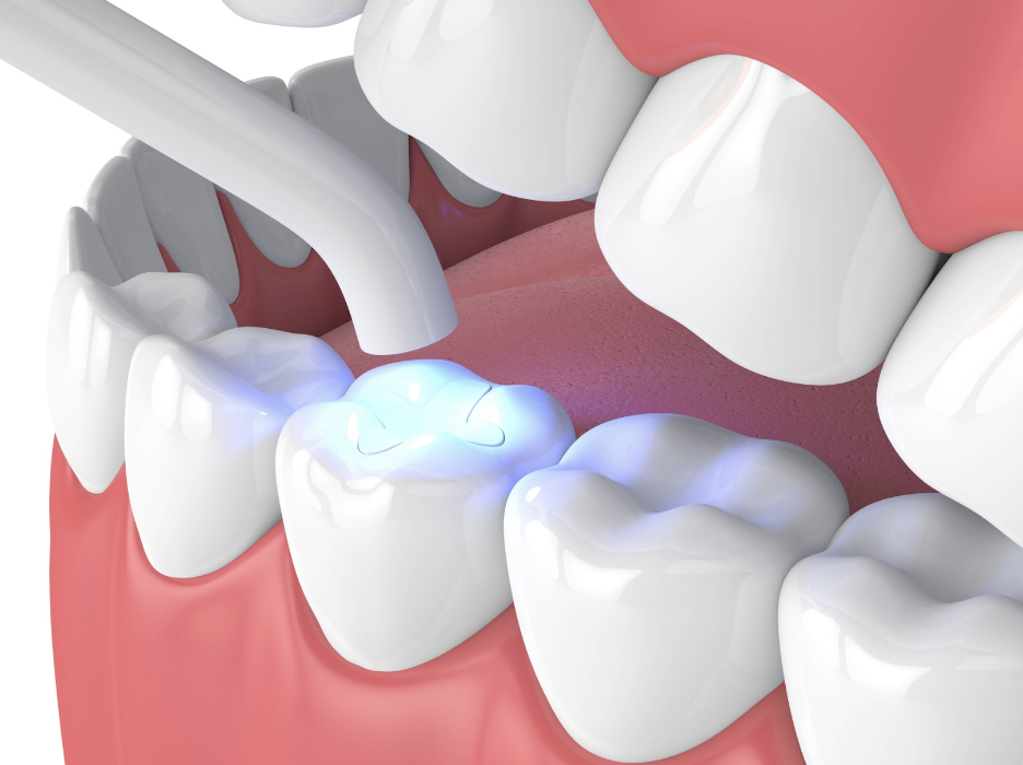 Toothache Albany Dental
